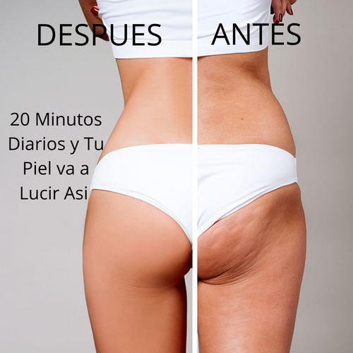 Masajeador 4 en 1 Anticelulítico + Ebook Gratis